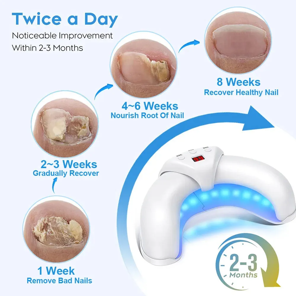 Nail Fungus Laser Device – Multi-Nail Treatment for Home Use