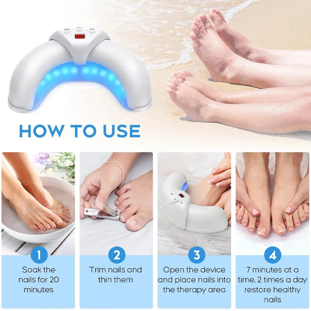 Nail Fungus Laser Device – Multi-Nail Treatment for Home Use