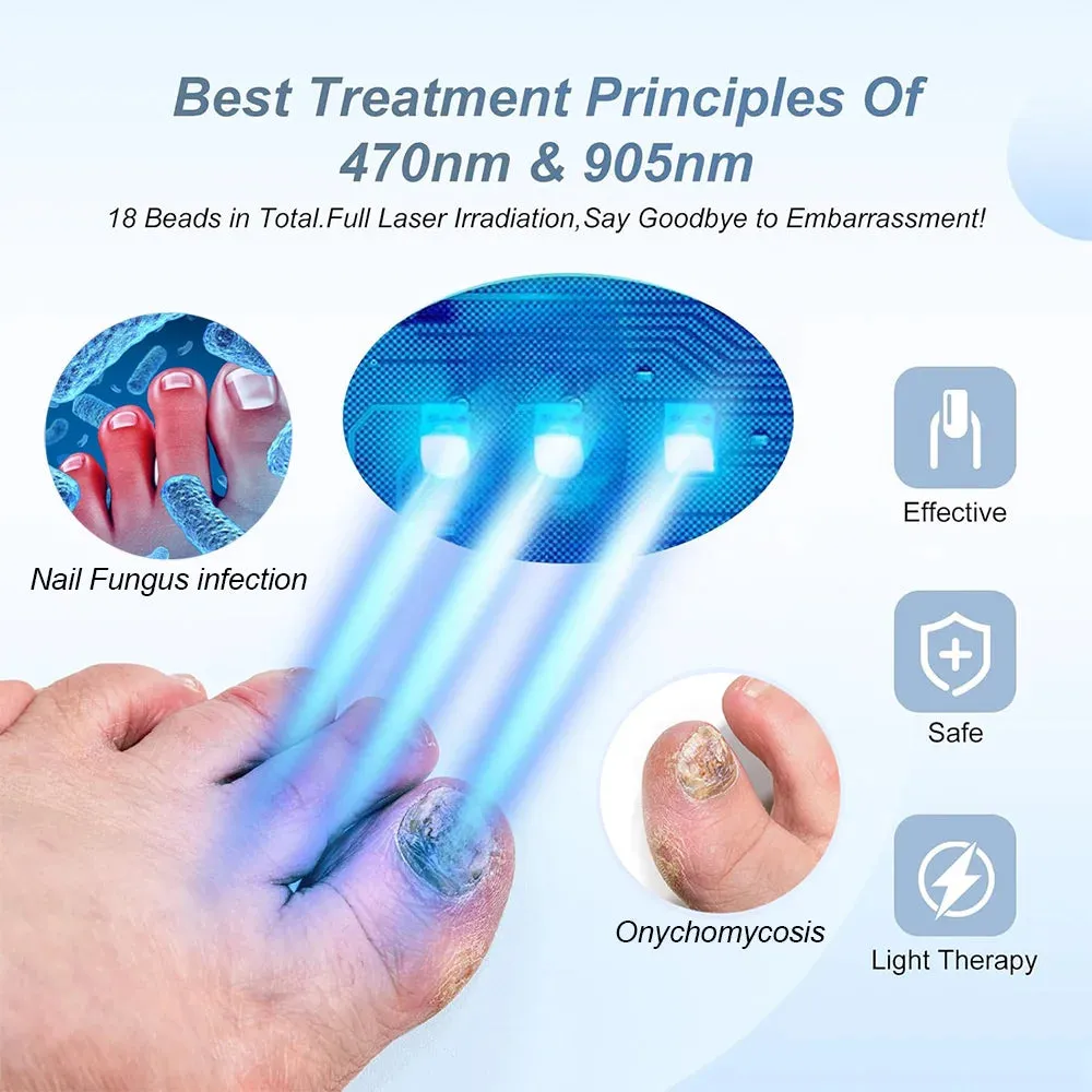 Nail Fungus Laser Device – Multi-Nail Treatment for Home Use