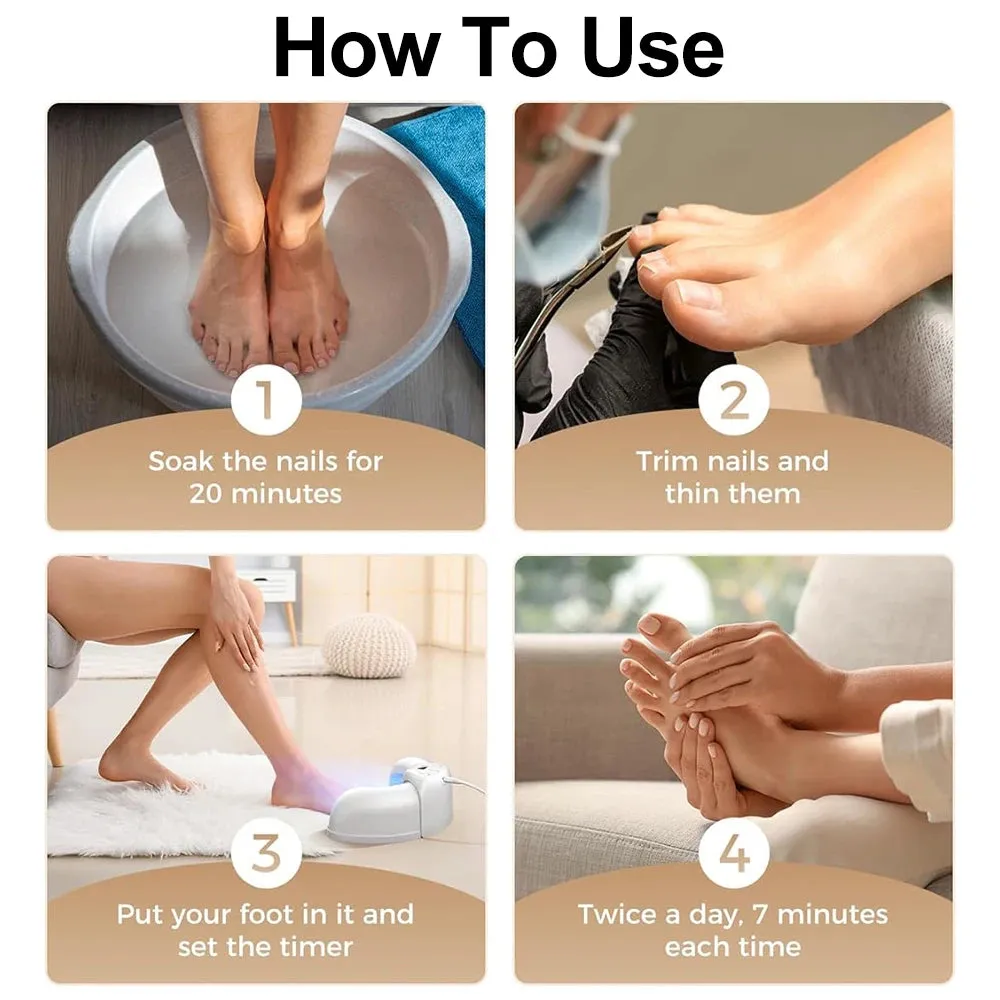 Nail Fungus Laser Device – Multi-Nail Treatment for Home Use